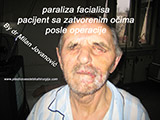 After the plastic surgery After the plastic surgery
