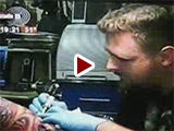 Plastic surgeon Dr. Milan Jovanovic - Studio B, Prime News